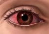 Bayer to offer Eylea 2mg to treat retinal diseases at lower cost in India