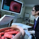 gastro endoscopy