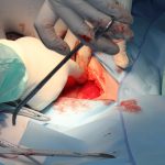 hospital-721241_1920