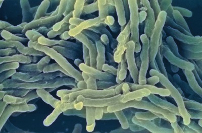 Mycobacterium tuberculosis image ©Crown copyright 2017. Multi- and extensively-drug resistant tuberculosis (MDR & XDR TB) is one of the biggest challenges facing mankind.