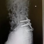 Sujata Spinal Pic