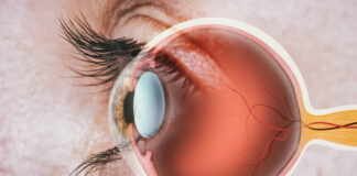 Nucleome Informatics unveils DrSeq IRD panel for advanced diagnosis of retinal diseases