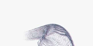 Abbott introduces its most advanced drug eluting stent ‘XIENCE Skypoint’ in India